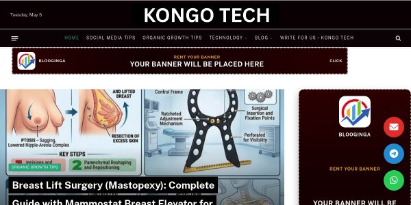 Link Placement On Kongotech.org
